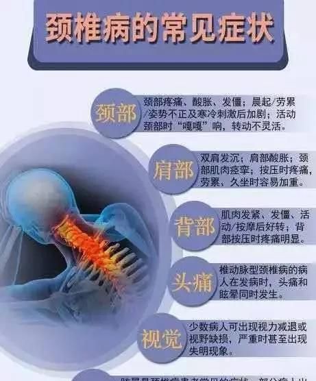 得了颈椎病怎么办？试试新加补阳还五汤