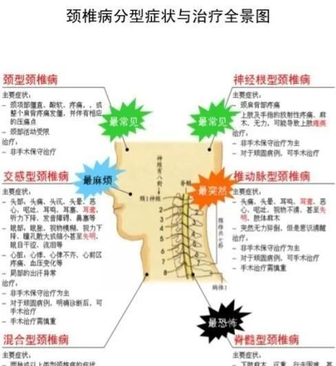 得了颈椎病怎么办？试试新加补阳还五汤