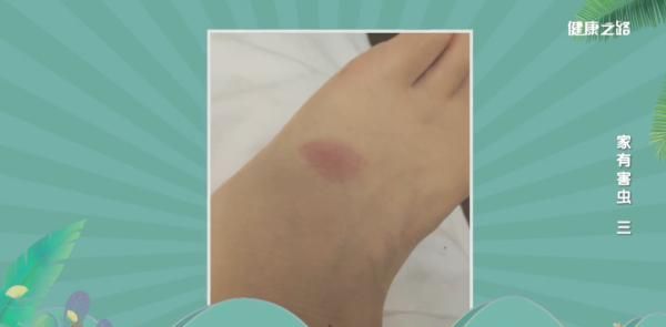 科学除蚁两步走，先要定点找窝，然后寻线放饵