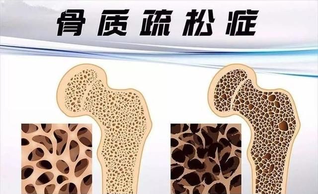 吃“知了猴”有什么危害吗？别乱猜，医生道出实情，早了解不吃亏