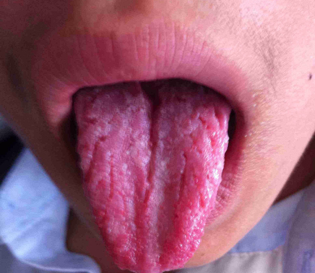 肾好百病消，两味中药泡水，滋肾阴 补肾阳，增强免疫 让你远离疾病