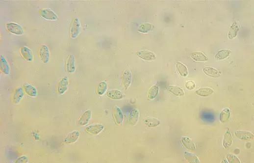 猫咪滴虫怎么治(猫咪得三毛滴虫)图2