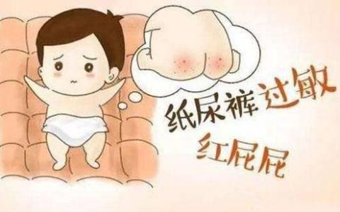 小儿肛门红怎么办