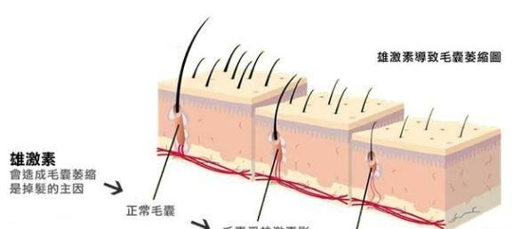 哪些洗发水可以缓解掉头发的情况图3