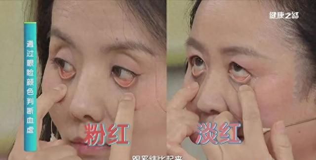 都说当归补血效果好，但专家提醒：当归“身”和“尾”，效用不同需对症！