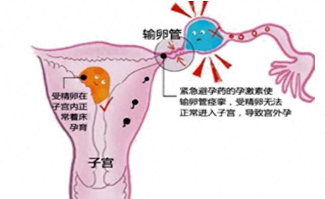 内分泌系统疾病用药，避孕药