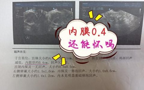 人流后子宫内膜薄吃什么食物好(人流导致子宫内膜薄吃多少中药)