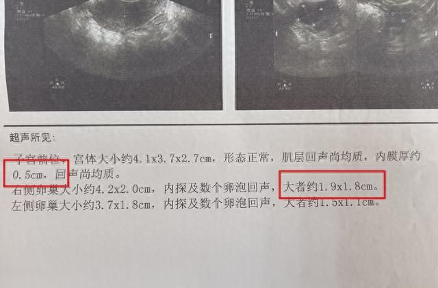 人流后子宫内膜薄？山东医生：食物这么吃内膜长得好