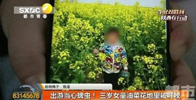 紧急提醒！出门一定要小心它！否则被咬后，可能命就没了