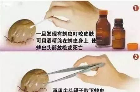 紧急提醒！出门一定要小心它！否则被咬后，可能命就没了